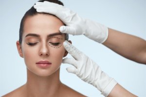 Blefaroplastia