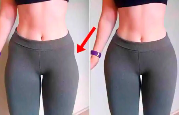 Comparación de una mujer con hip dips y sin ellas