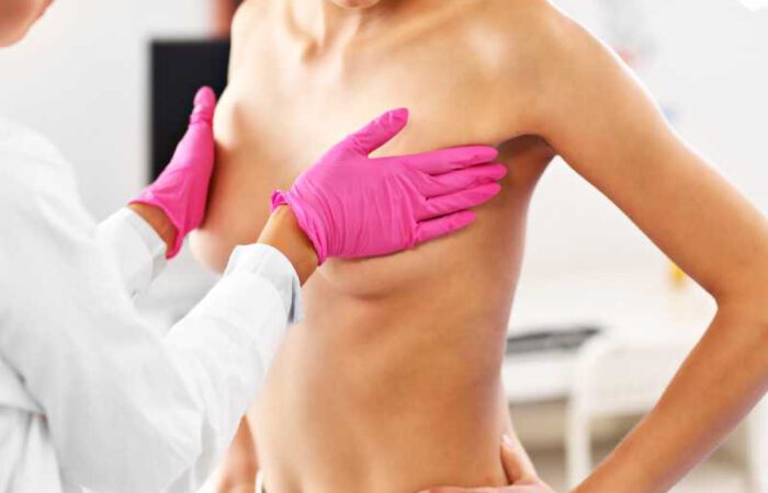 Implantes mamarios, cada cuánto se cambian