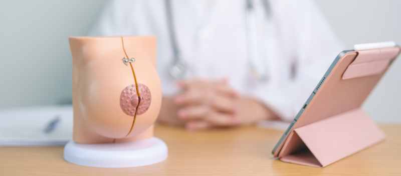 Cuidados postoperatorios para mamas con expansor mamario