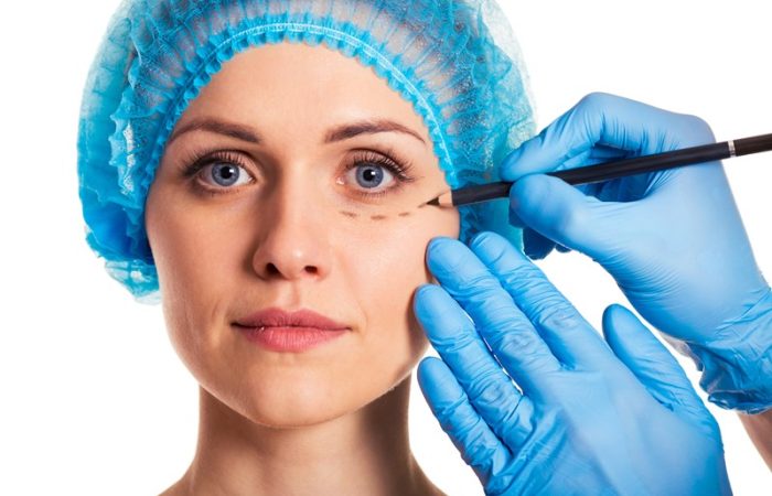 Cirugía para párpados caídos: una joven mujer caucásica mira a la cámara mientras se prepara para la cirugía estética de blefaroplastia.
