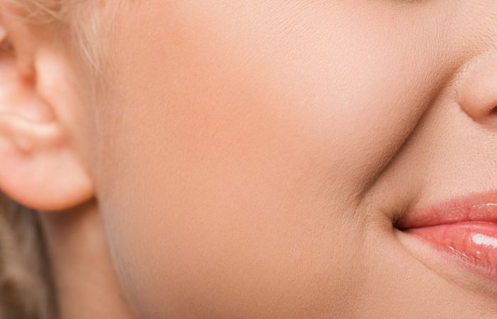 Qué son las bolas de Bichat: primer plano del rostro de una mujer blanca que muestra su mejilla derecha