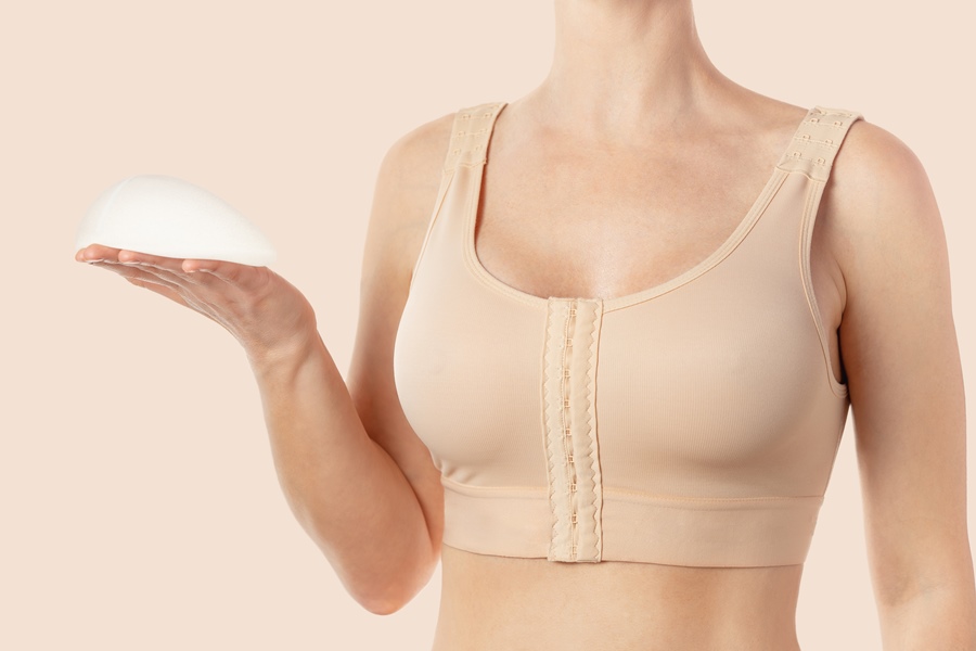 El postoperatorio de un recambio de prótesis mamarias suele ser más llevadero que el de la primera cirugía de aumento de pecho.