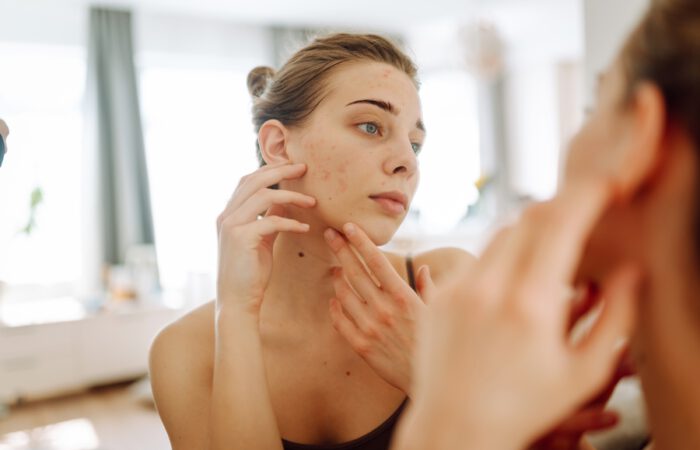 Las manchas en la piel son una preocupación estética y dermatológica que afecta a personas de todas las edades.