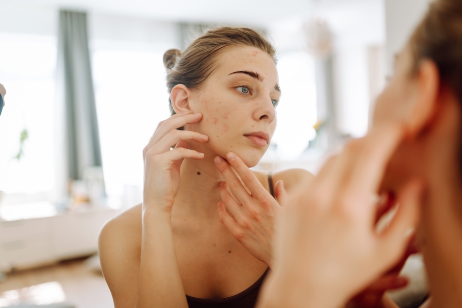 Las manchas en la piel son una preocupación estética y dermatológica que afecta a personas de todas las edades.