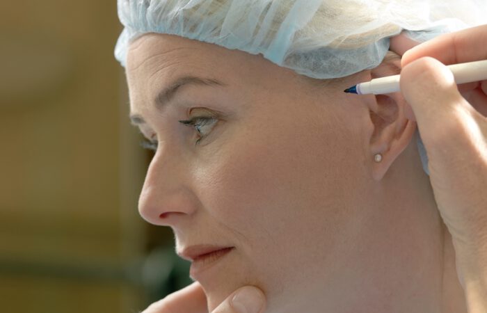 Qué es la cirugía estética: suele asociarse con un deseo de mejorar la apariencia física, pero su impacto va mucho más allá de lo visible