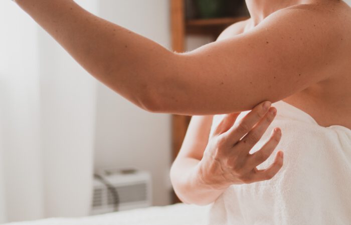 En algunos casos, la flacidez se combina con un exceso de grasa localizada. En estos casos, el lifting de brazos se puede complementar con liposucción.