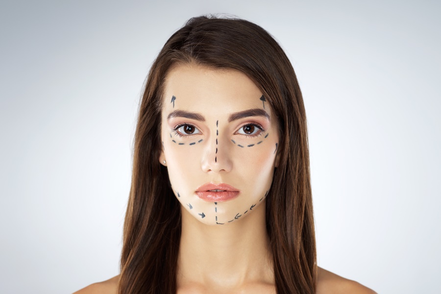 Representación de planificación de cirugía estética para procedimientos faciales combinados, con marcas faciales previas a la intervención quirúrgica.