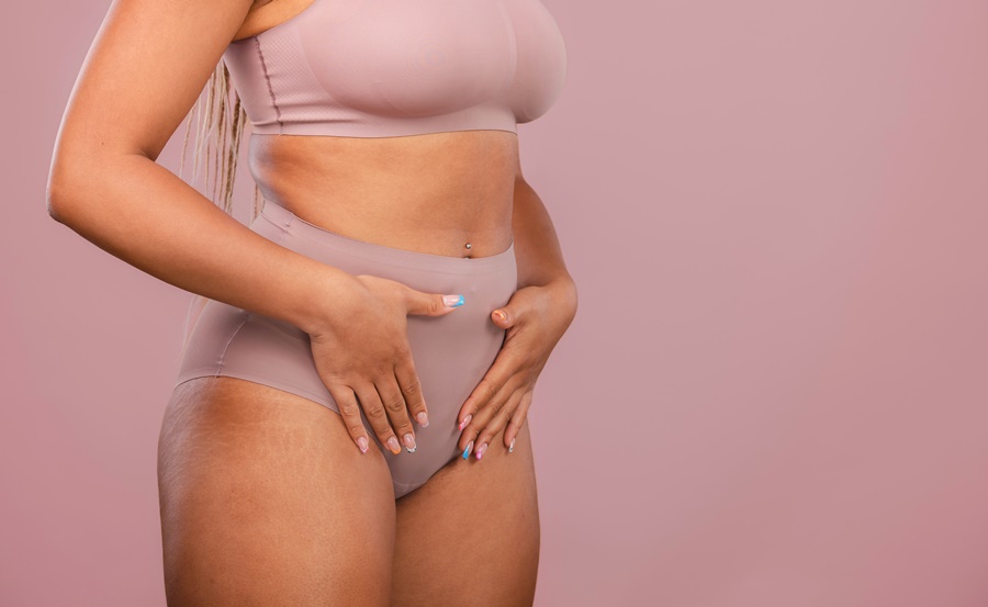 Imagen conceptual de una mujer tras una liposucción y reducción de monte de Venus, procedimiento destinado a mejorar la estética íntima.