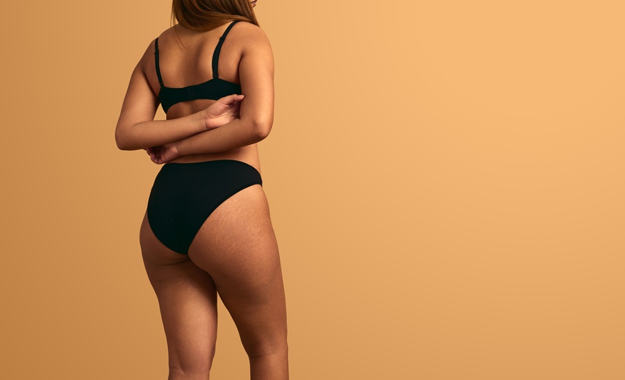 Contorno corporal posterior tras dermolipectomía de glúteos o flancos – cirugía estética.