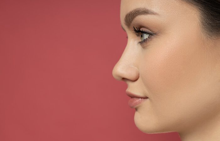Perfil facial armónico de una paciente mujer tras una rinoplastia estructural exitosa