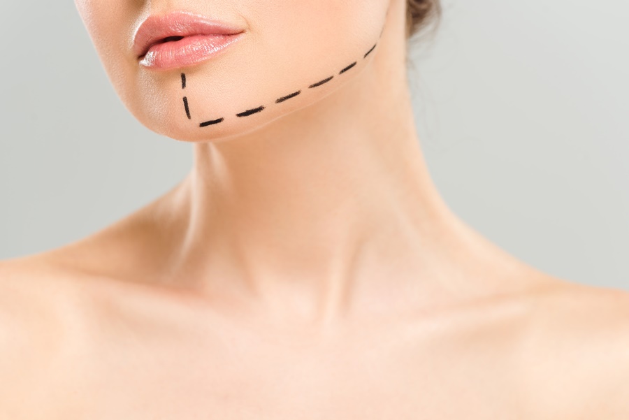 Primer plano del rostro y cuello de una mujer con marcas de cirugía estética en la mandíbula, asociado a genética y cirugía plástica.