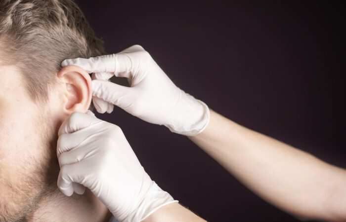 Examen previo a una otoplastia en adultos donde un profesional médico revisa la forma de la oreja de un paciente varón.