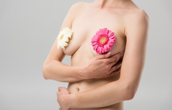 Mujer antes de una cirugía de reducción de areolas, en representación del equilibrio y la naturalidad buscados en la cirugía plástica mamaria.