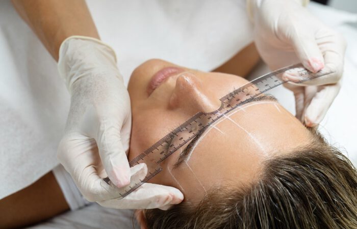 Medición de la línea de las cejas en un rostro femenino antes de un lifting directo de cola de cejas, con guantes y regla transparente sobre la frente.
